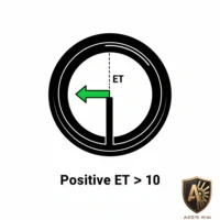 Diagram showing positive offset (ET) greater than 10 with an arrow inside a circle, Aegis Rim logo at the bottom.